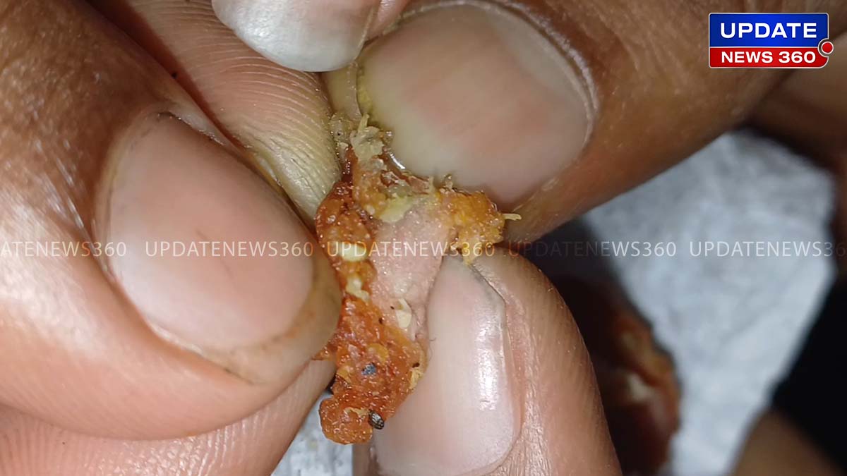 Worm in Rotten Chicken Fried Rice