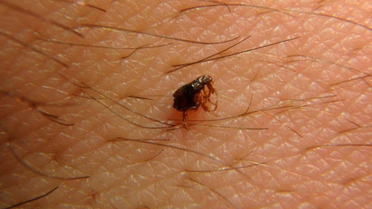 Scrub Typhus spreading methods in tamil  